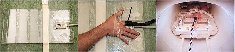 image illustrant le bruit articulaire lors d'une manipulation ostéopathique